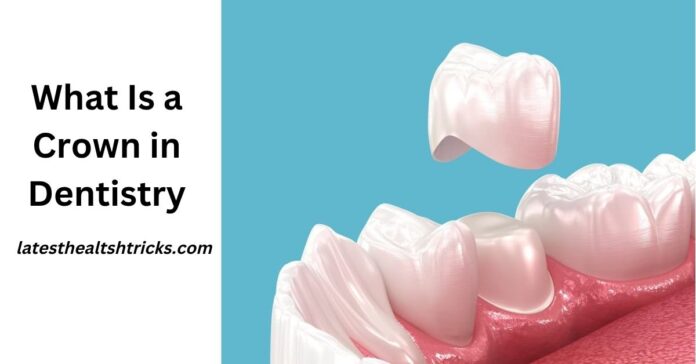What Is a Crown in Dentistry