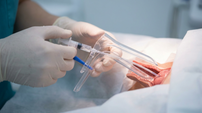 Understanding IUI Treatment and Factors That Influence Success Rates