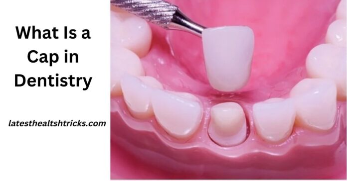 What Is a Cap in Dentistry