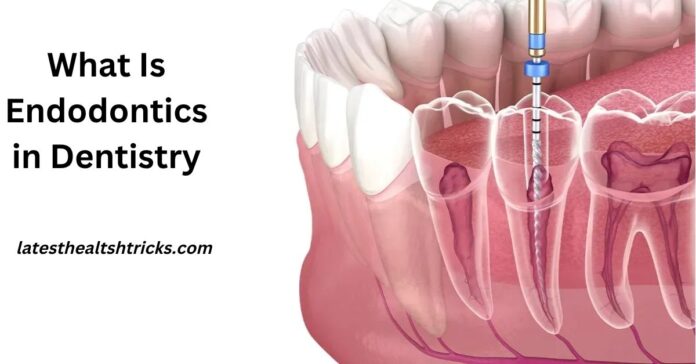 What Is Endodontics in Dentistry