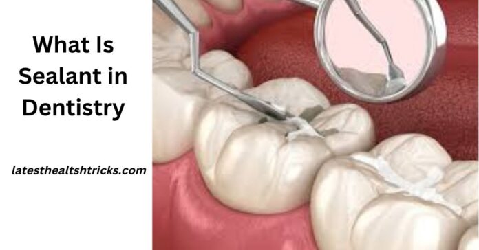 What Is Sealant in Dentistry