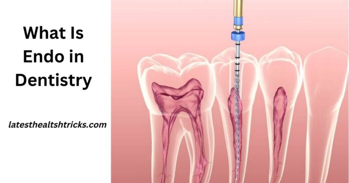 What Is Endo in Dentistry